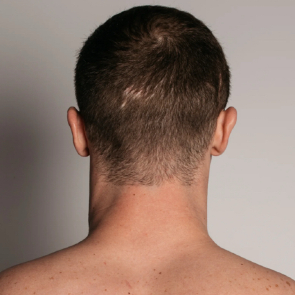 Neck at Skintuition Skincare Boutique in Pewee Valley, KY