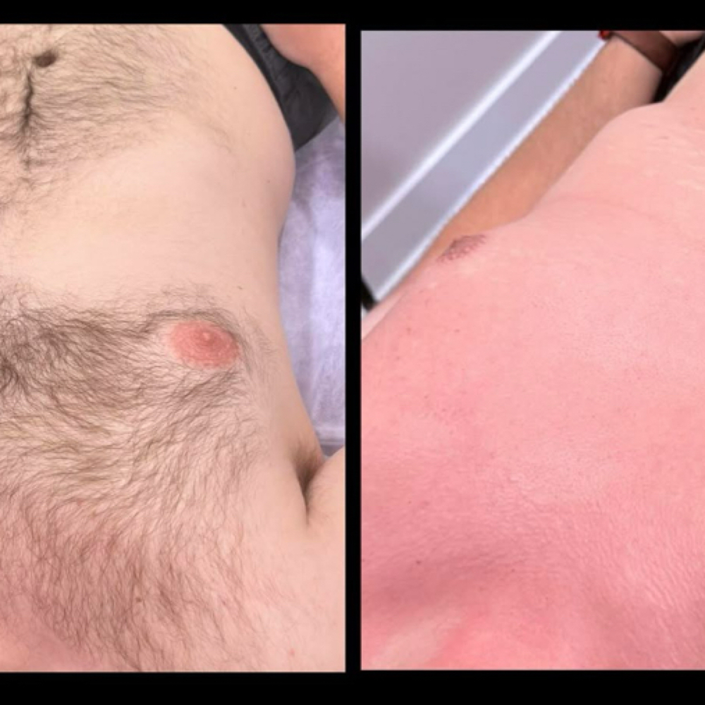 Chest & Back Wax at You Time in Clarksville, TN
