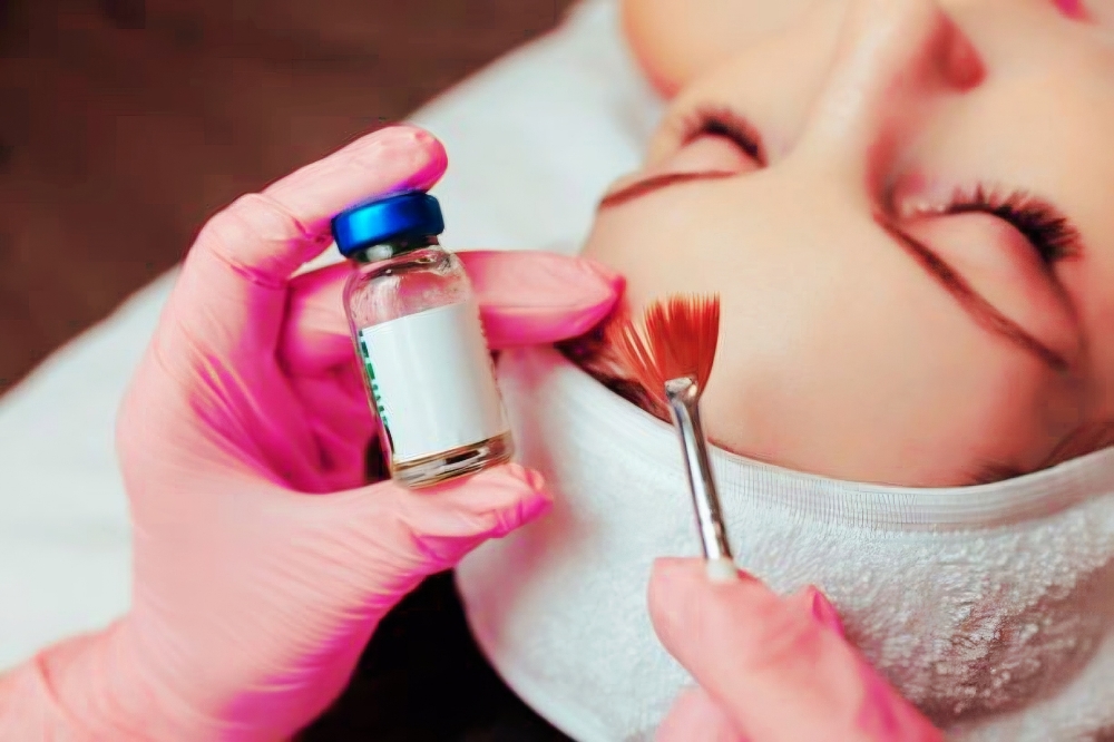 Chemical Peel Treatment