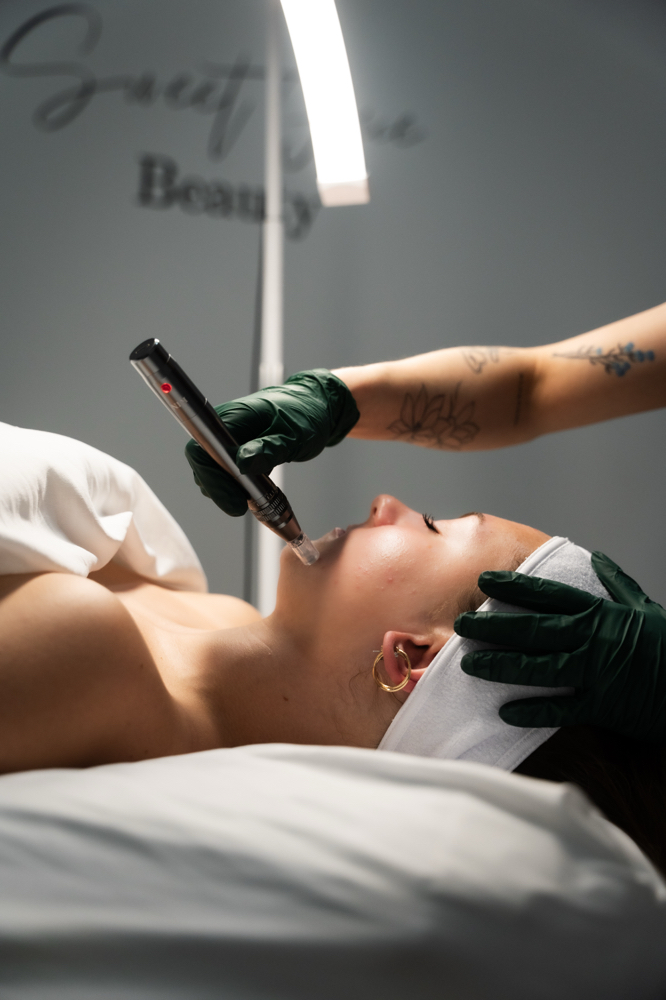 Micro Channeling Treatment