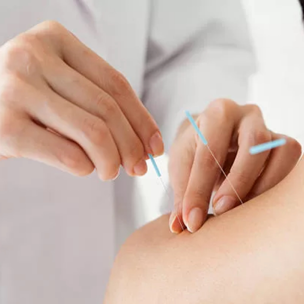 Acupuncture Wellness at Luméa Spa in Wilton, CT