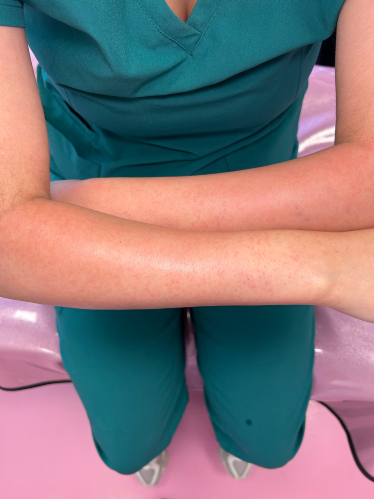 Half Arm Sugar at Her Beauty in San Jose, CA