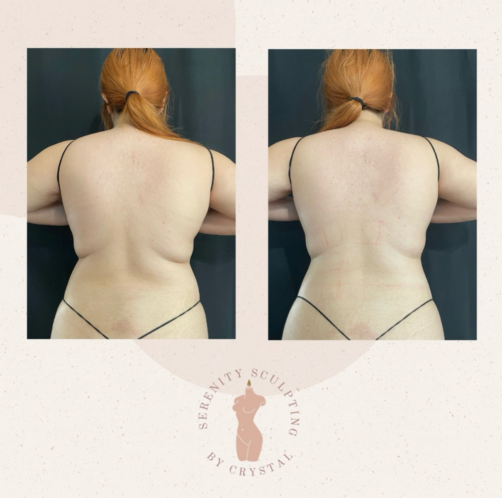 The Sculpted Back at Serenity Sculpting in Madera, CA