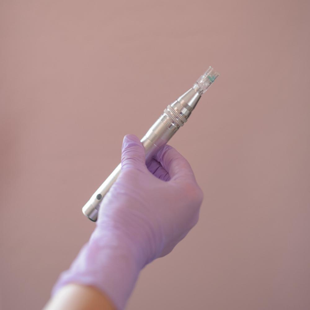 Microneedling Package Of 3 at Timeless Glow in Eagar, AZ