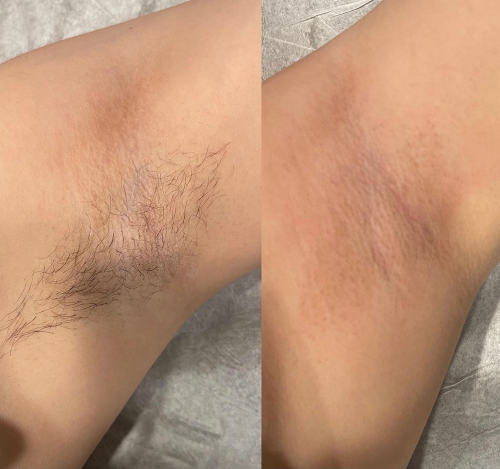 Under Arm Wax
