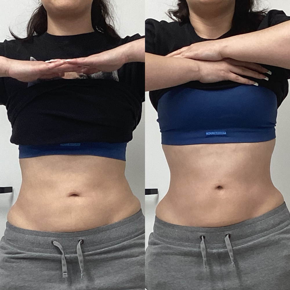 Topical Fat Dissolve/Skin Tight