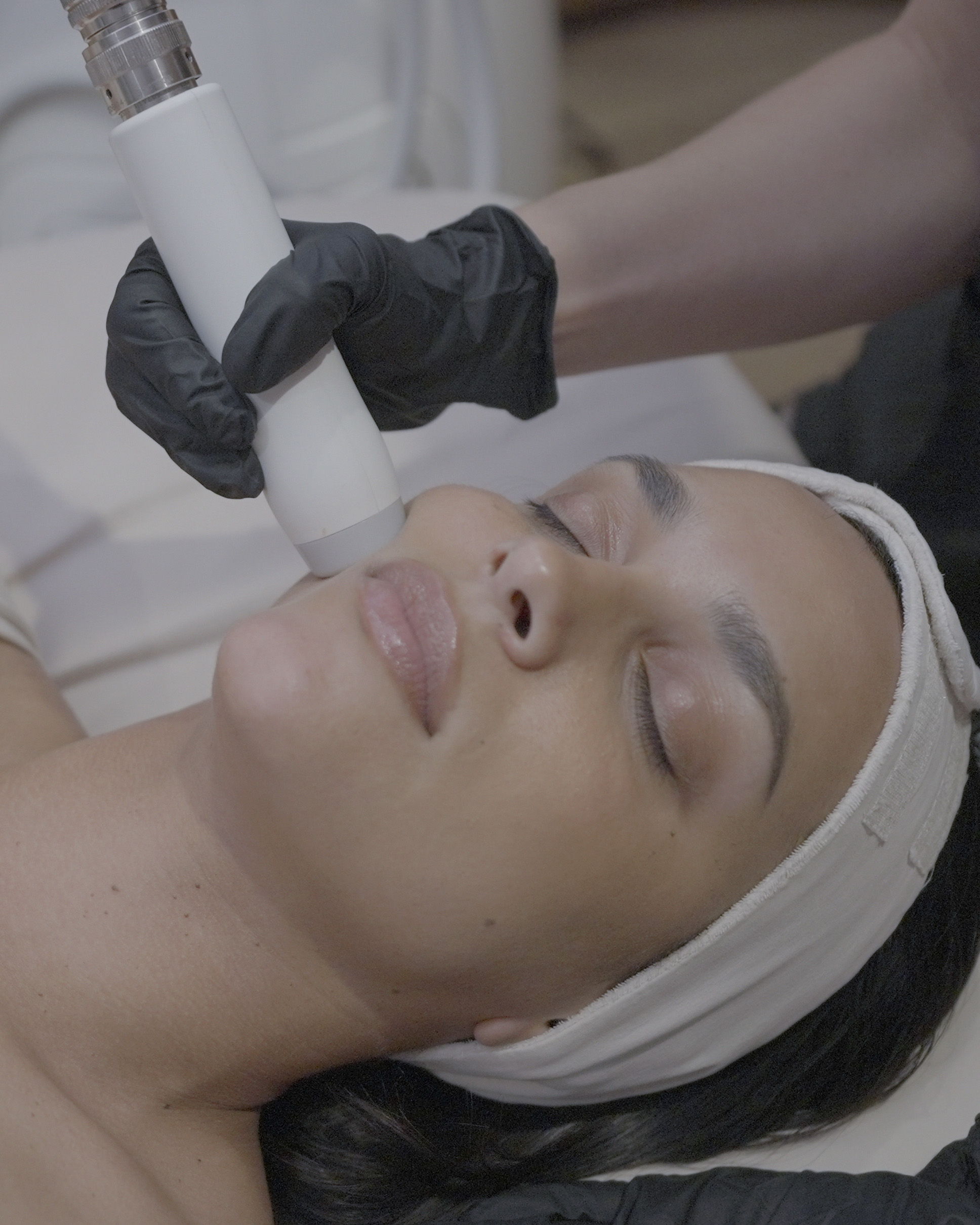 T-Shape Facial Skin Tightening