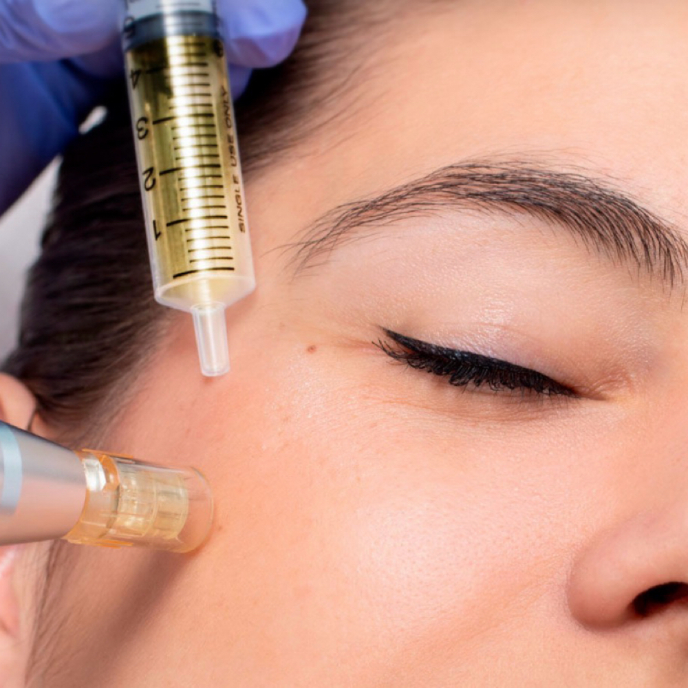 Exosomas Treatment Facial at Ana Aesthetic & Beauty in Freeport, NY