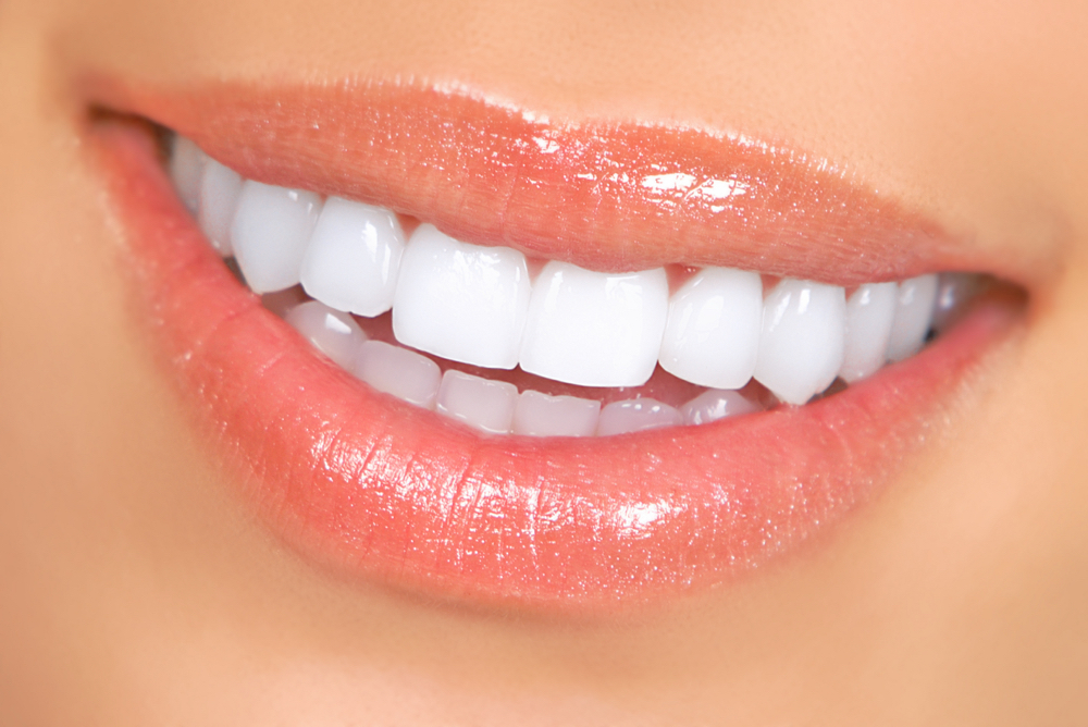Teeth Whitening