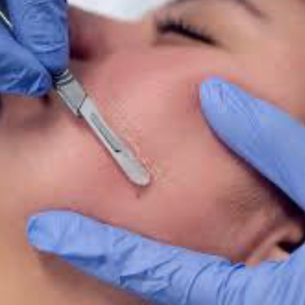 Dermaplaning Facial at Coastal Beauty Spa in Riverview, FL