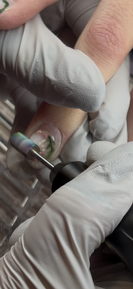 Enhancement Removal