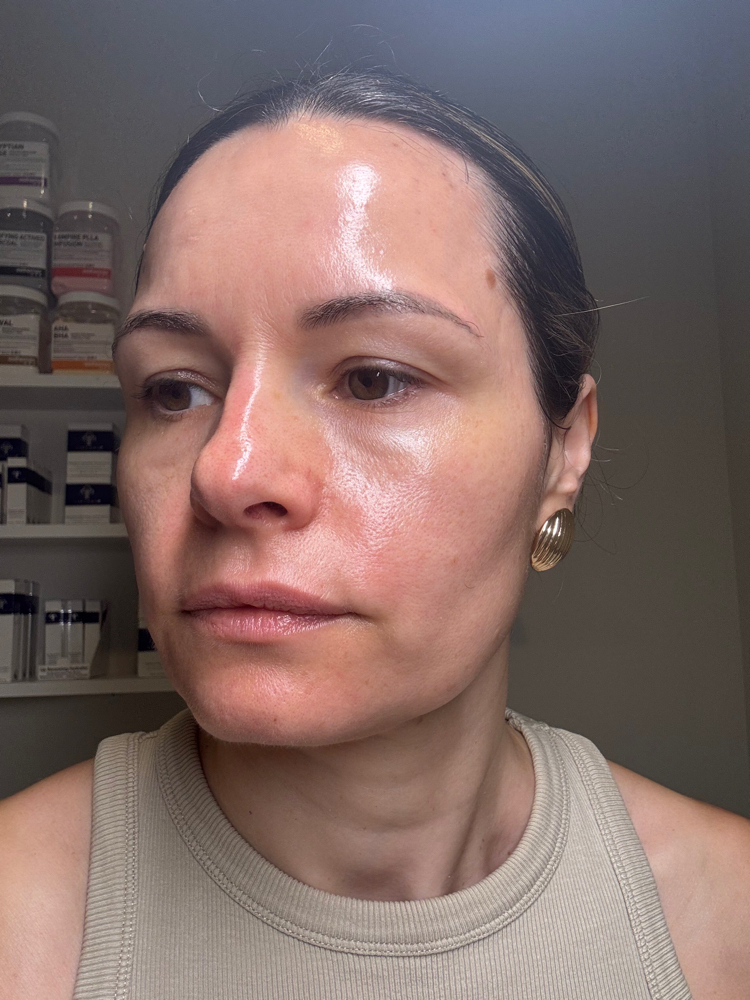 SWICH Dermal Revitalization System