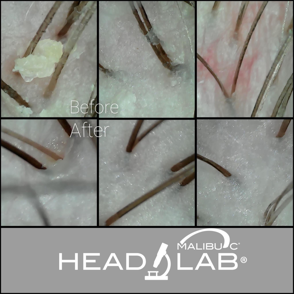 Head Spa Deluxe