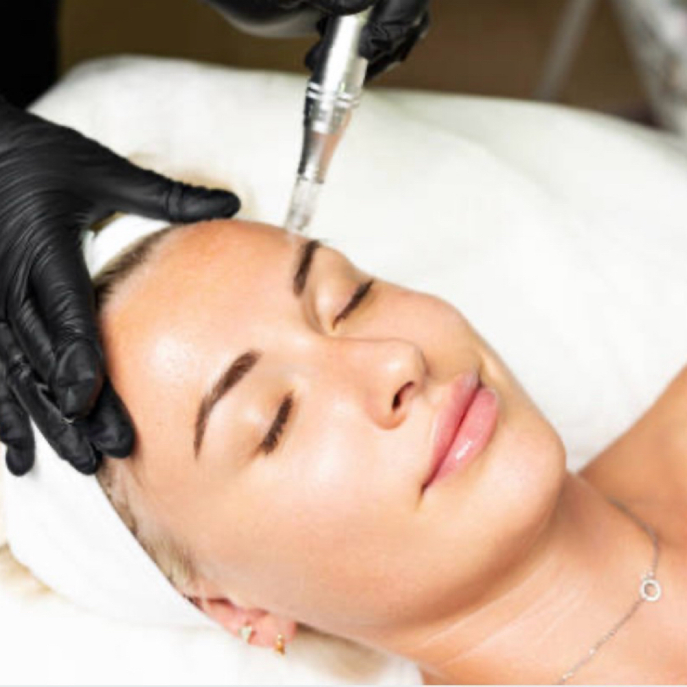 Microneedling With Exosomes at Jenny Kane Skin Care in Glenview, IL