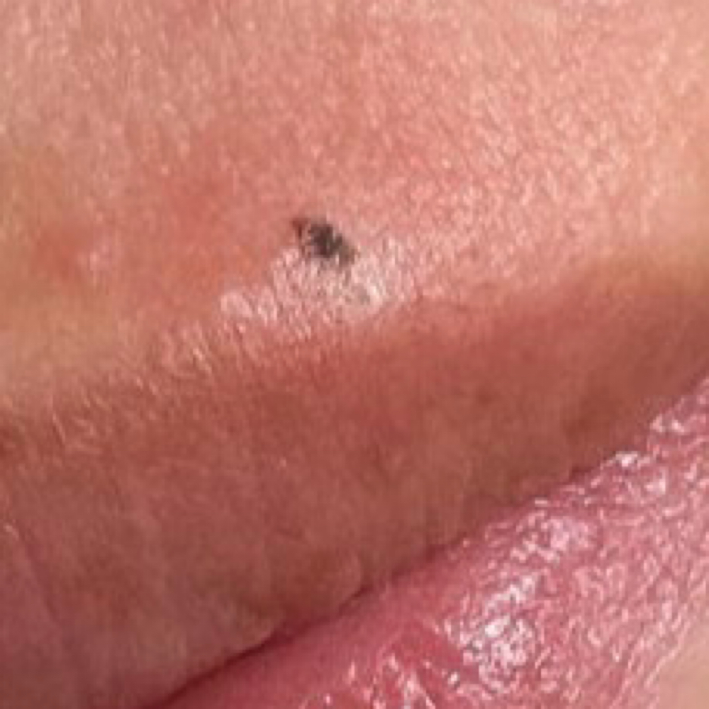 Beauty Mark at Beautyy By RD in Beaumont, CA