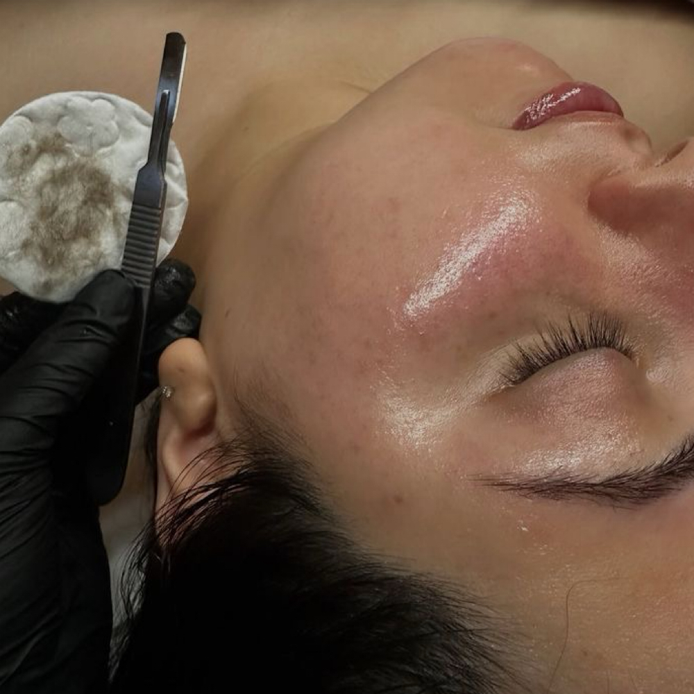 Flash Dermaplane Sale ⚡️ at Face The Facts With Liv in Deridder, LA