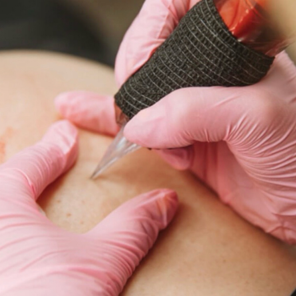 Scar Camouflage at Avaia Beauty in Thatcher, AZ