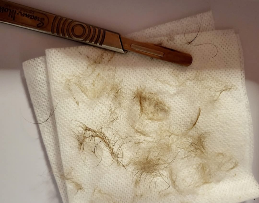 Add On Dermaplaning