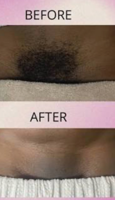 Brazilian Wax