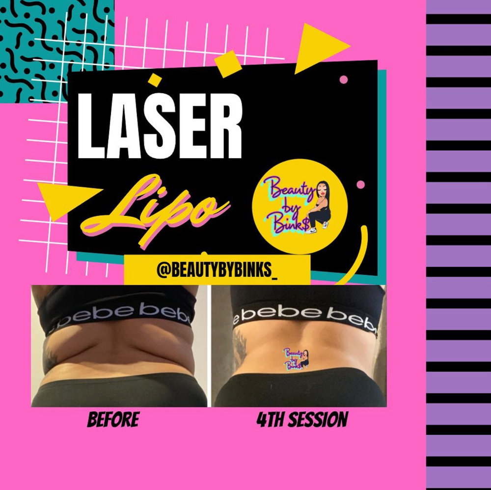 1 Month Laser Lipo Treatment Plan