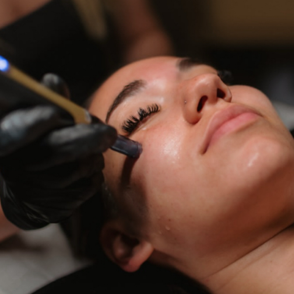 Nano Needling Facial at Esthetics By Alana in Texarkana, TX
