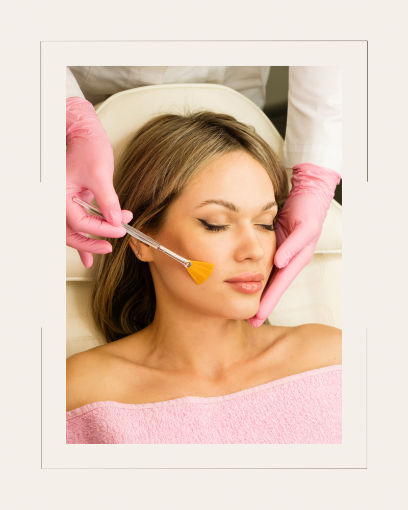 Chemical peel