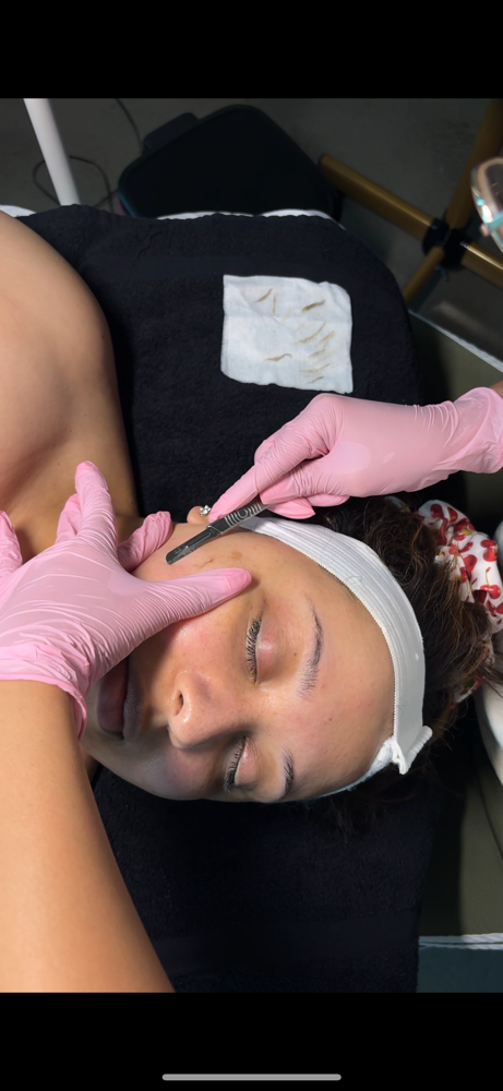 Dermaplane Facial