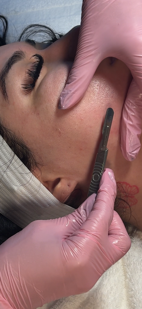 Dermaplane Facial at Reydiant Skin in Las Vegas, NV