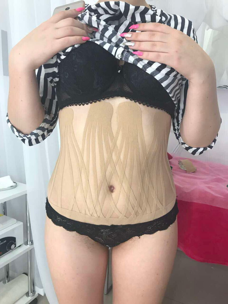 Body Taping