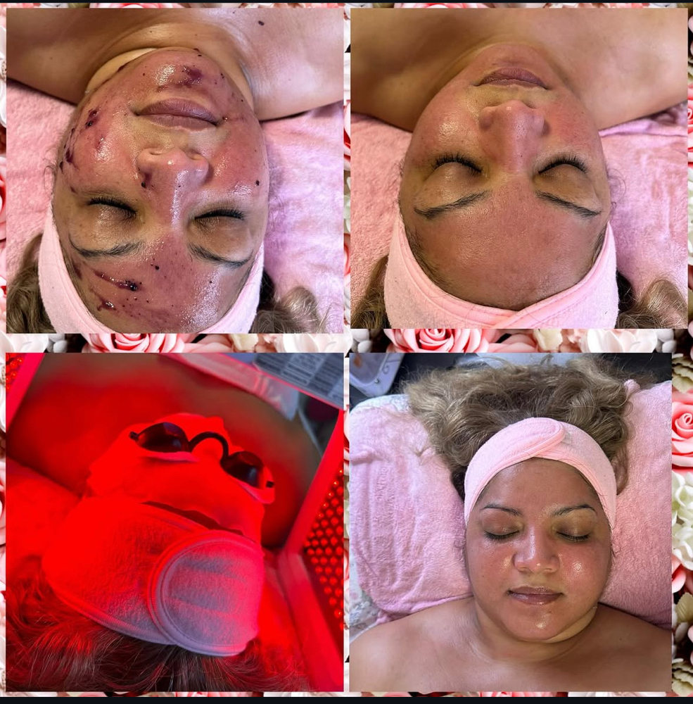 Basic Facial