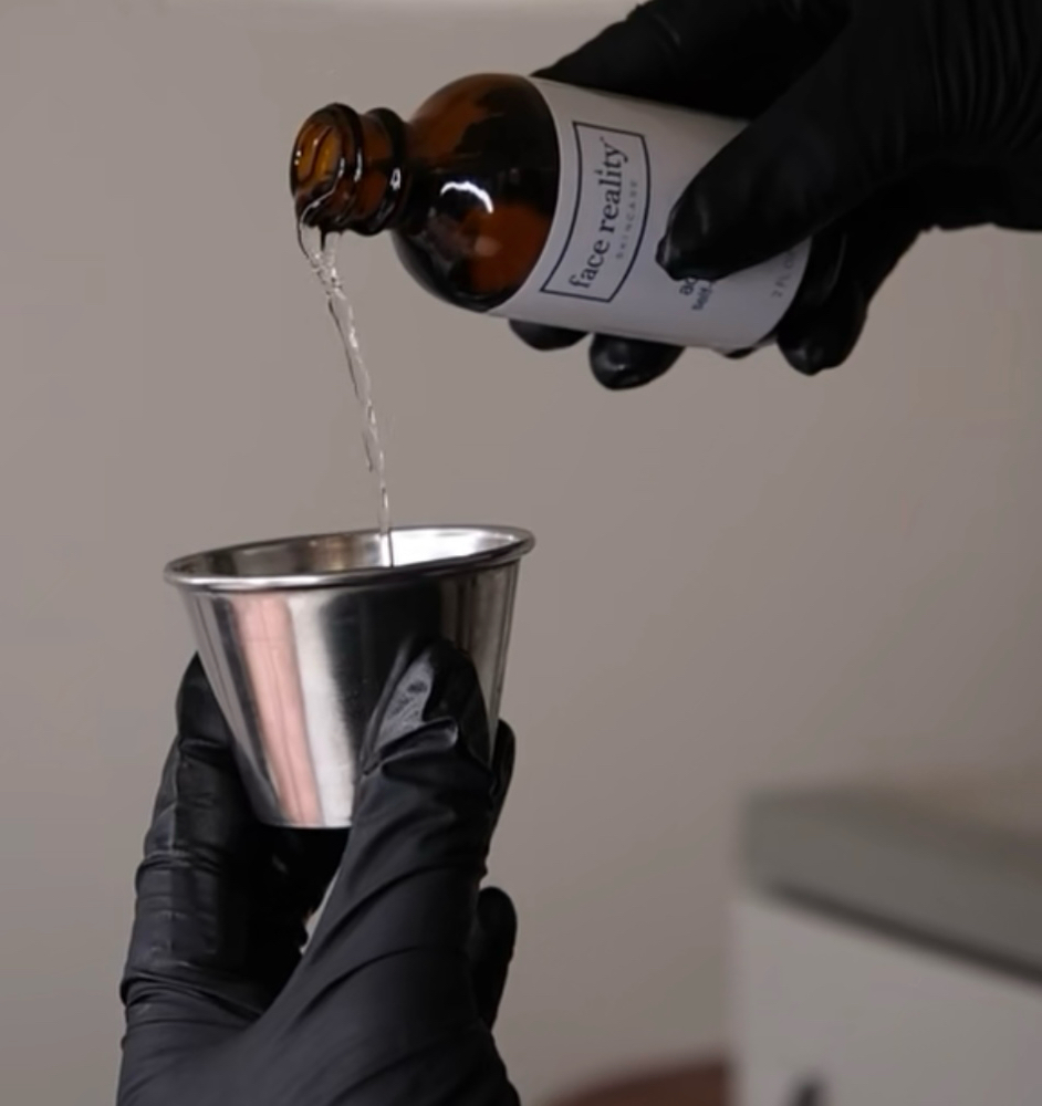 CHEMICAL PEEL