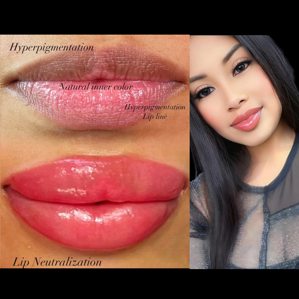 Lip Neautralization