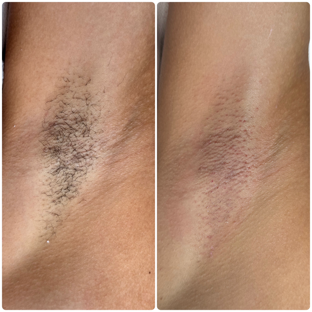 Underarm Wax