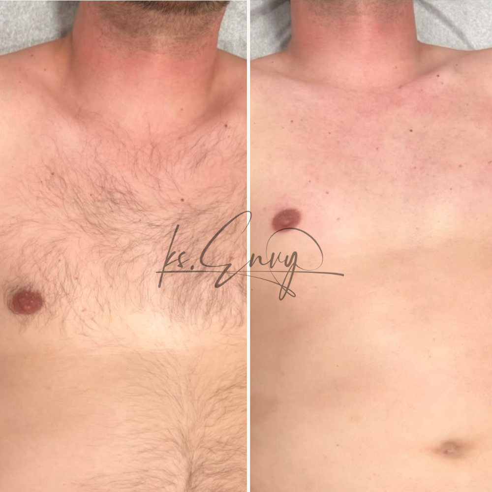 Chest (Full) at KS.Envy in Columbus, OH