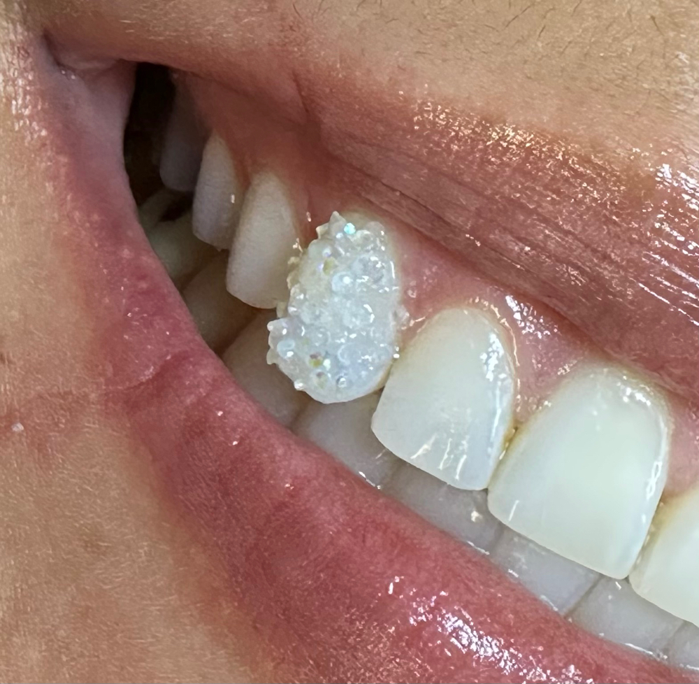 Chandelier Tooth Gem