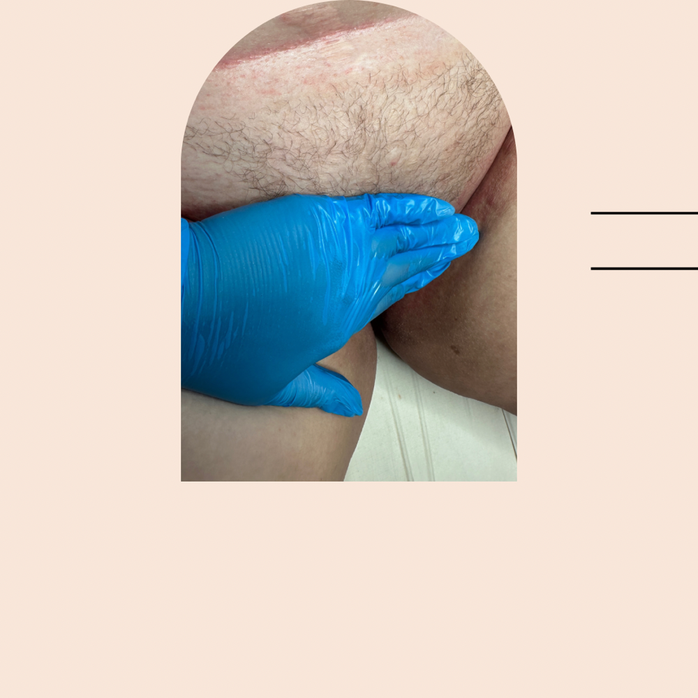 Bikini Wax at Reverie Skin Lab in London, KY