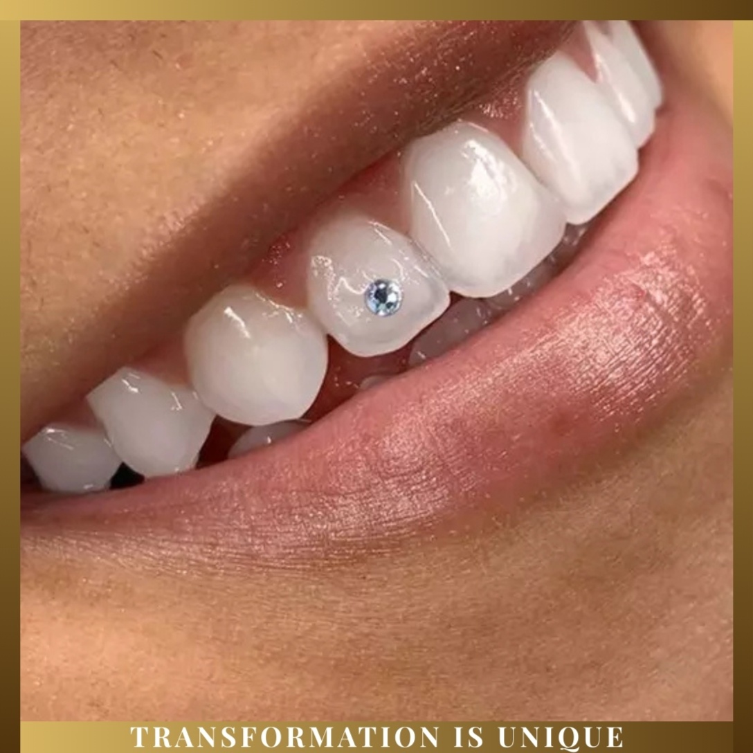 Tooth Gems (Swarovski)