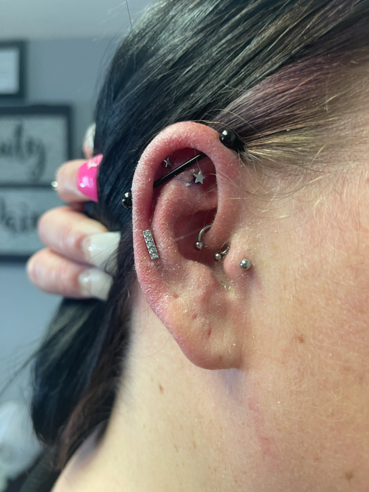 Helix X1