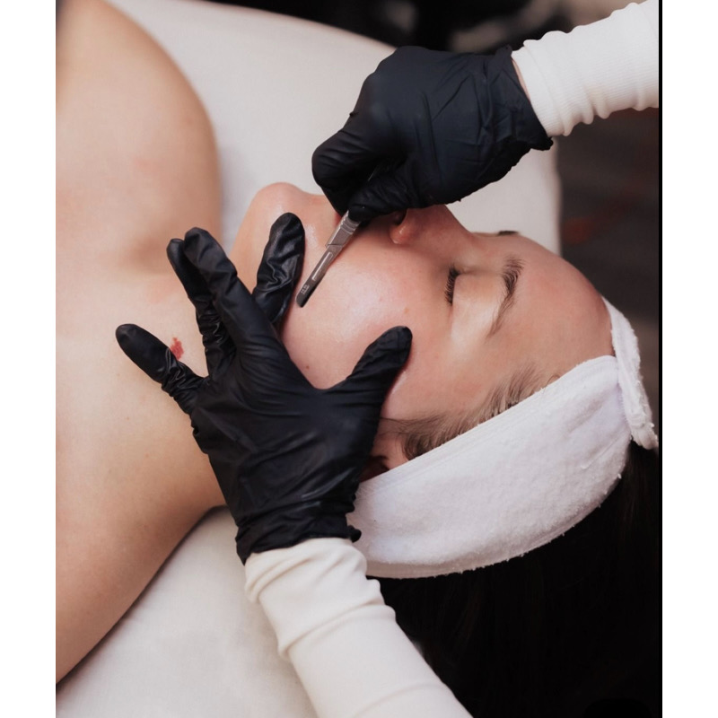 Signature Dermaplaning Facial at PureBeauty-Aesthetics in Colorado Springs, CO