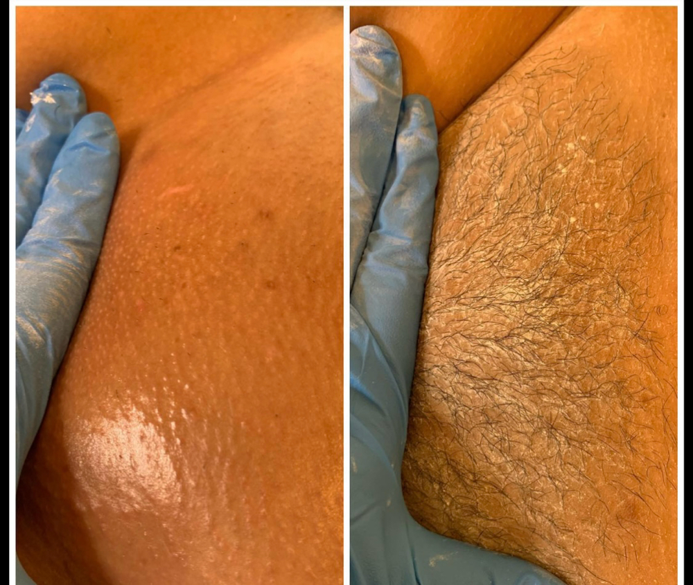 Brazilian wax female at Get Frosted lux Spa in Wauchula, FL