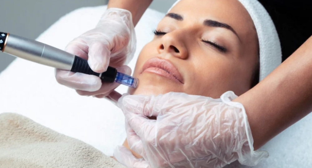 Microchanneling Collagen Induction