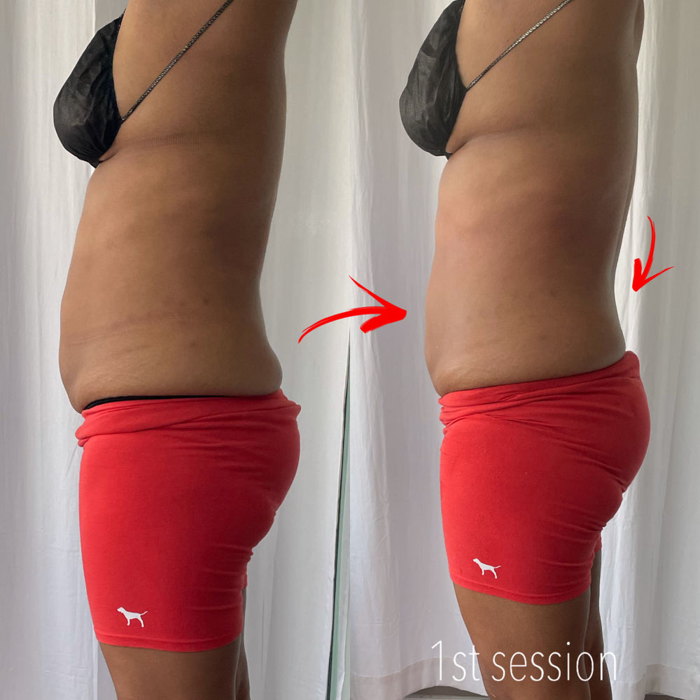Single Treatment