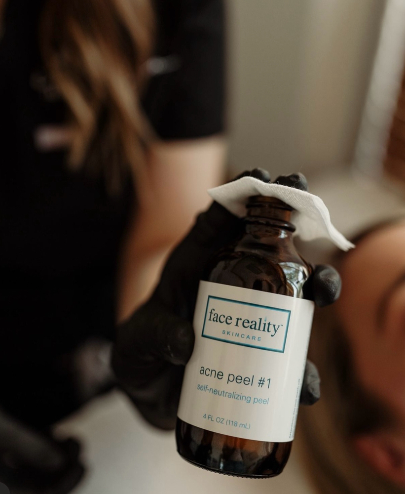 Acne Bootcamp Tx