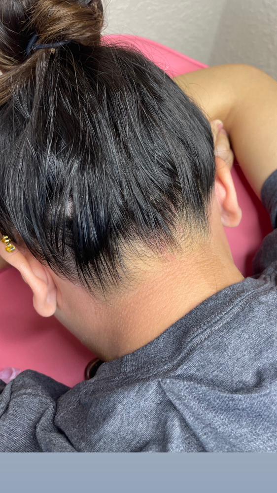 Hair Line
