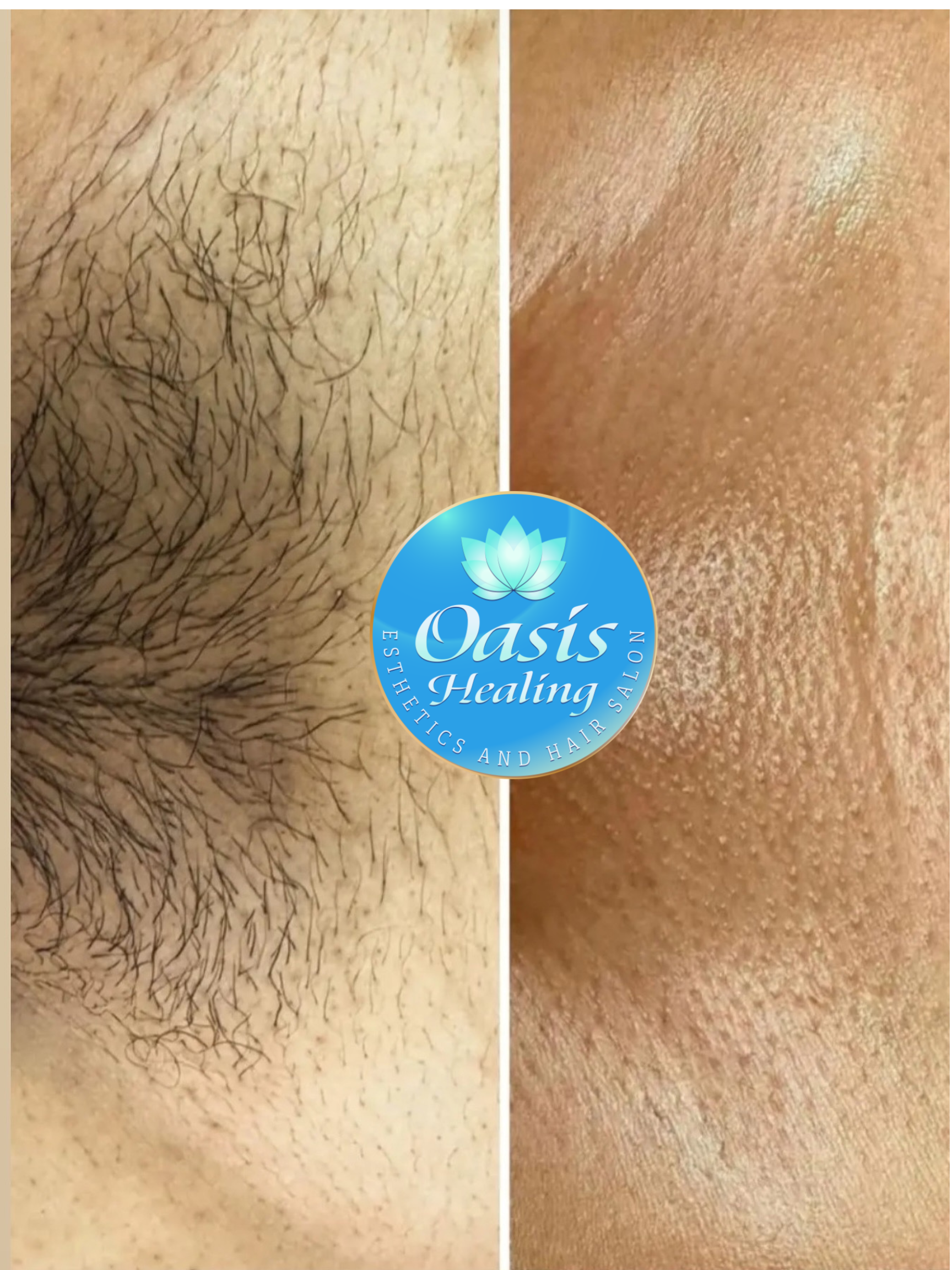 Brazilian Bikini Wax