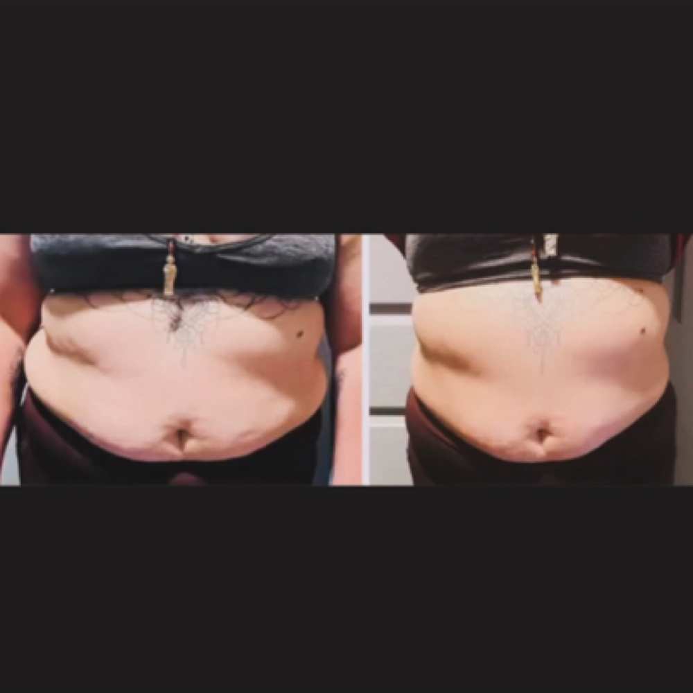 Body Sculpting at Glamorous Brows|Skin|Lashes in Cedar Hill, TX