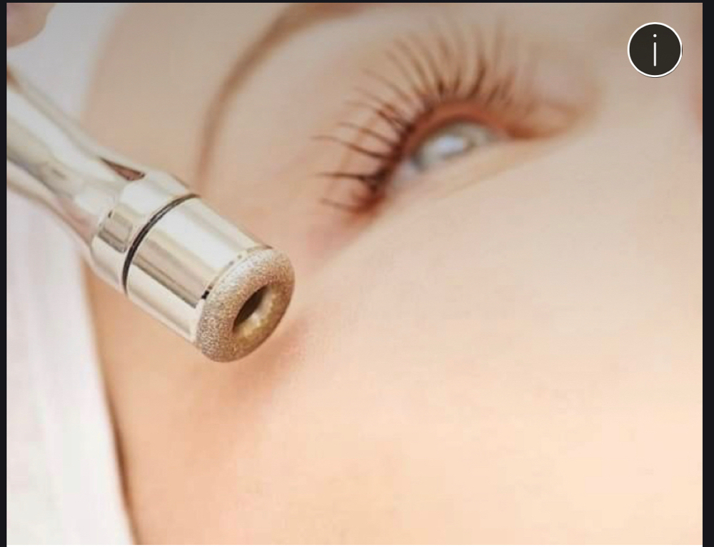 Diamond Tip Microdermabrasion