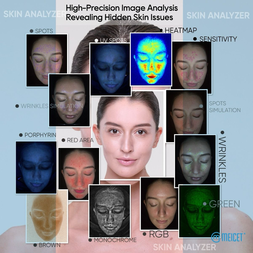 Ai Skin Analysis at Millennium Day Spa in Inglewood, CA