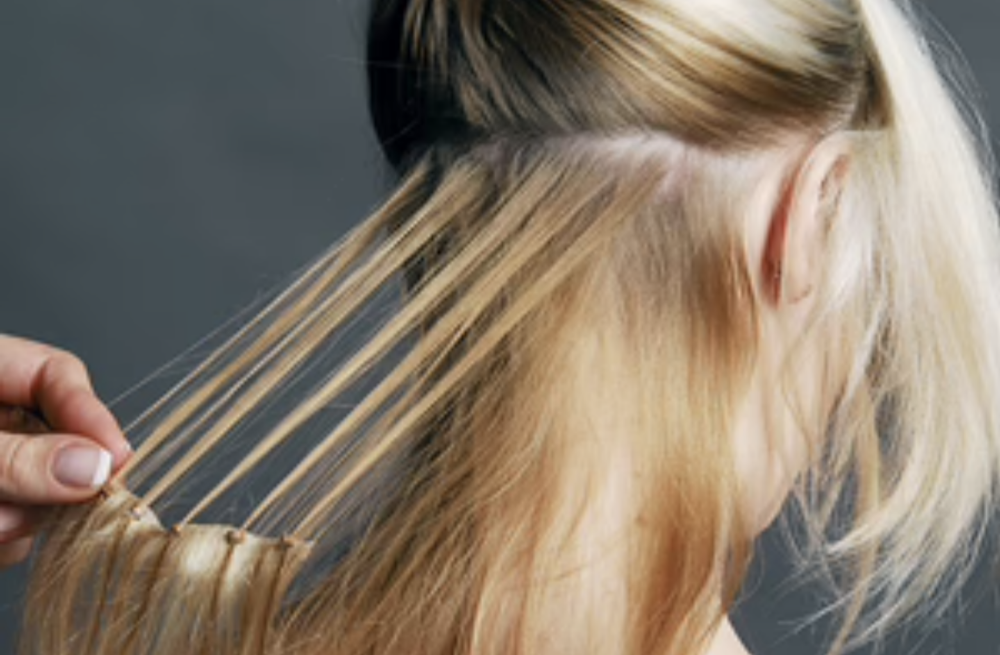 Extensions Removal