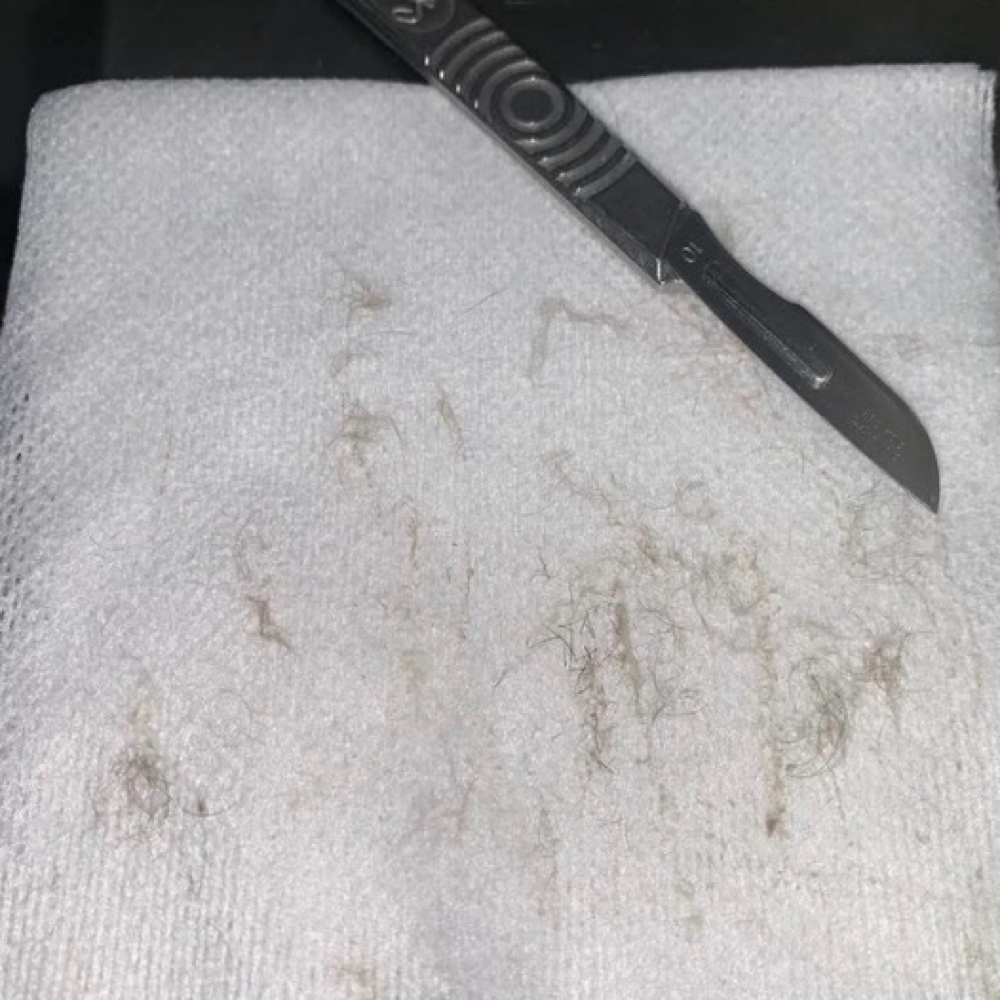 Dermaplane at The Studio Beat in Warren, OH
